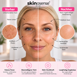 Microneedling Gesichtspflege-Set von skinosense mit verschiedenen Pflegeprodukten und Zubehör für eine strahlende Haut.