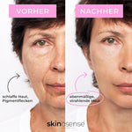 Augenpads von skinosense® mit Hyaluron gegen Augenringe, 10 Stück, hautfreundliche Pflege für die Augenpartie.