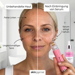 Microneedling Gesichtspflege-Set von skinosense mit Hyaluron, Retinol und Vitamin C für glatte, strahlende Haut.